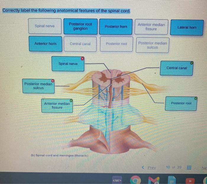 Features label anatomical following correctly adjust problems points award cord spinal pdf preview