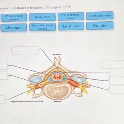 Correctly label the following anatomical features of a vertebra