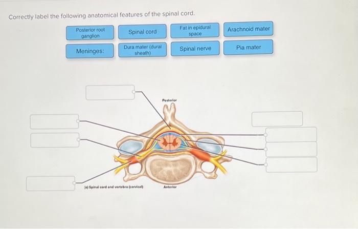 Correctly label the following anatomical features of a vertebra