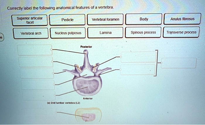 Correctly label the following anatomical features of a vertebra